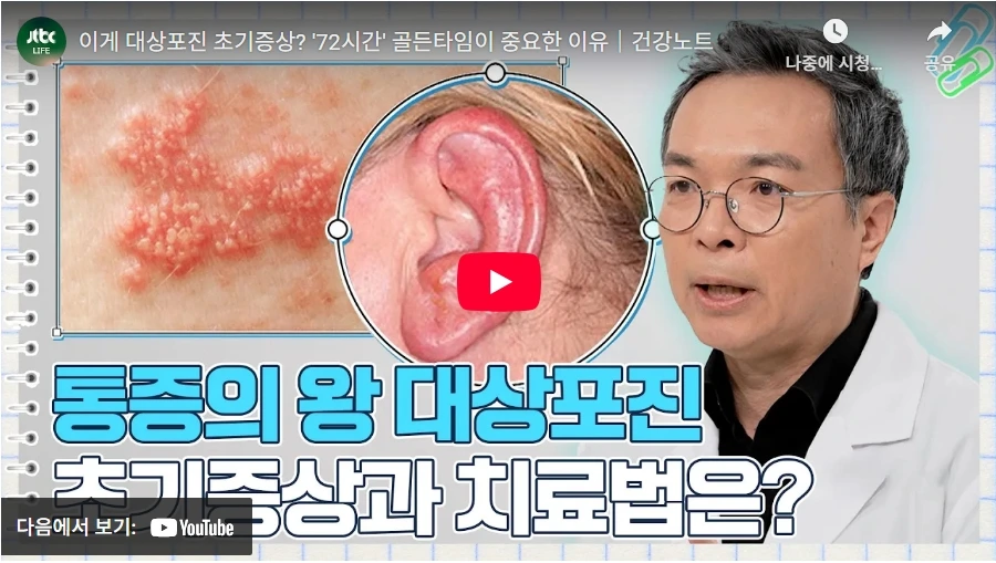 이게 대상포진 초기증상? '72시간' 골든타임이 중요한 이유